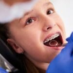 Protect Your Child’s Oral Health with Medicare Kids Free Dental
